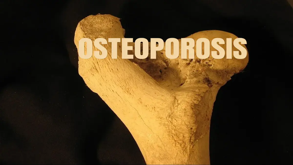 Calcium supplements questioning their effectiveness against osteoporosis.