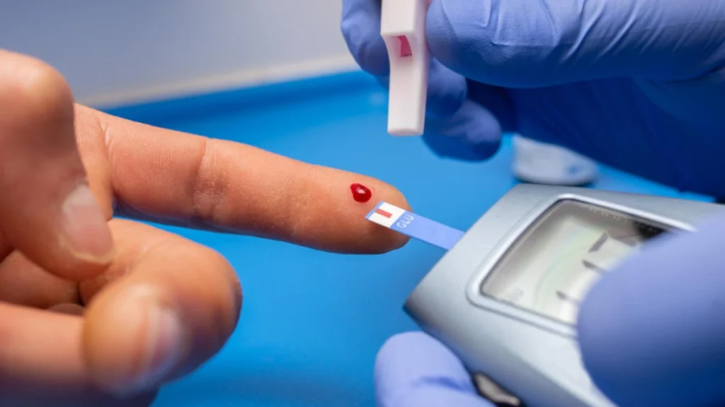 Blood type B and type 2 diabetes risk concept with glucose monitoring