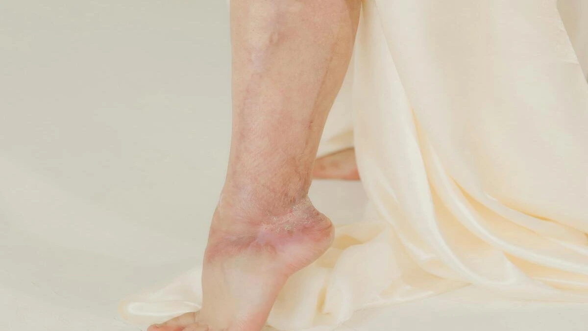 Healthcare professional examining a diabetic patient’s foot for wounds and ulcers