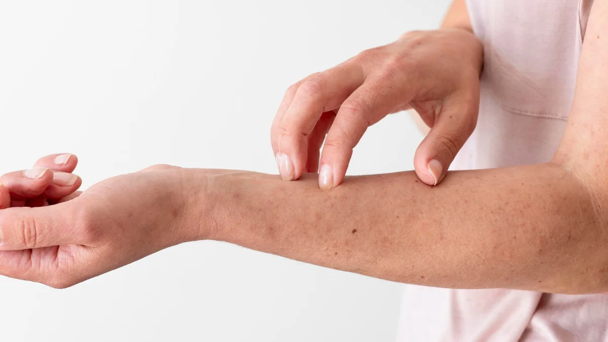 Immune cells and cytokines driving chronic skin inflammation in psoriasis and eczema with targeted biologic treatment pathways