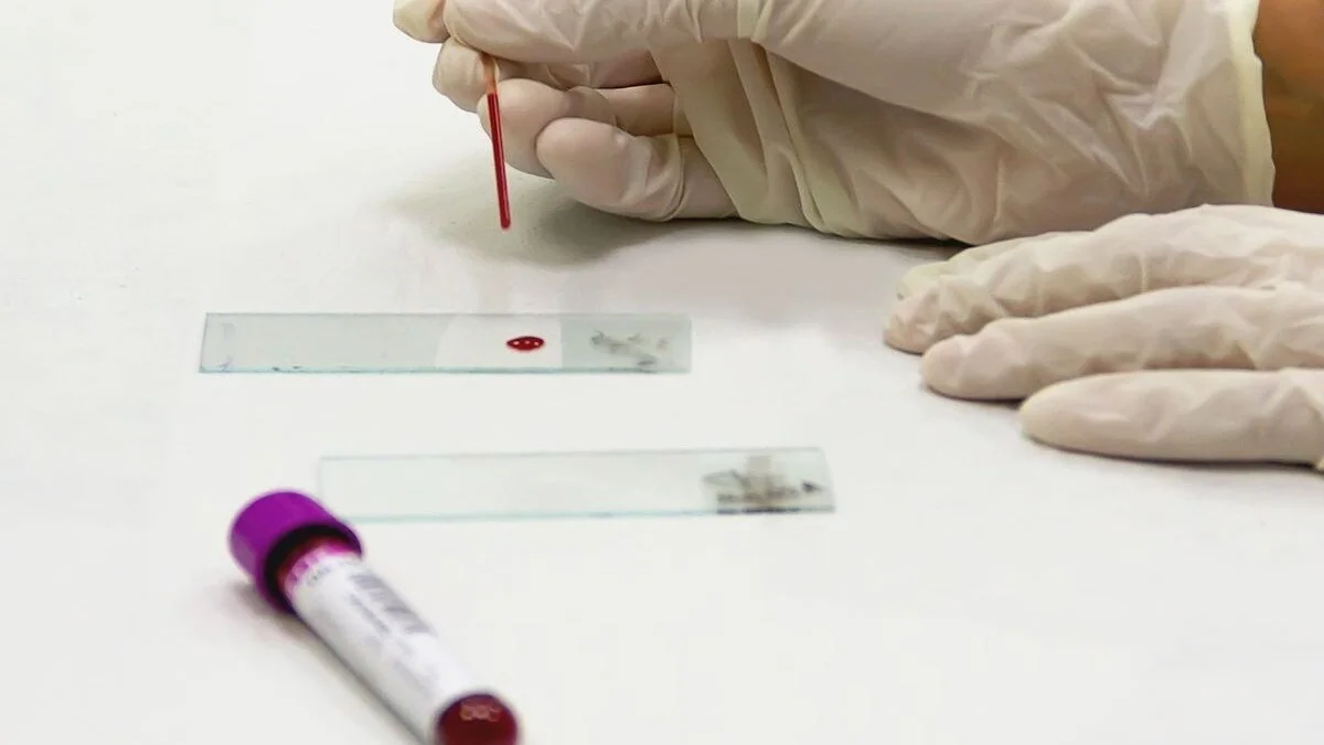 Athlete blood test concept showing ferritin levels, iron status, and endurance performance relationship in sports nutrition